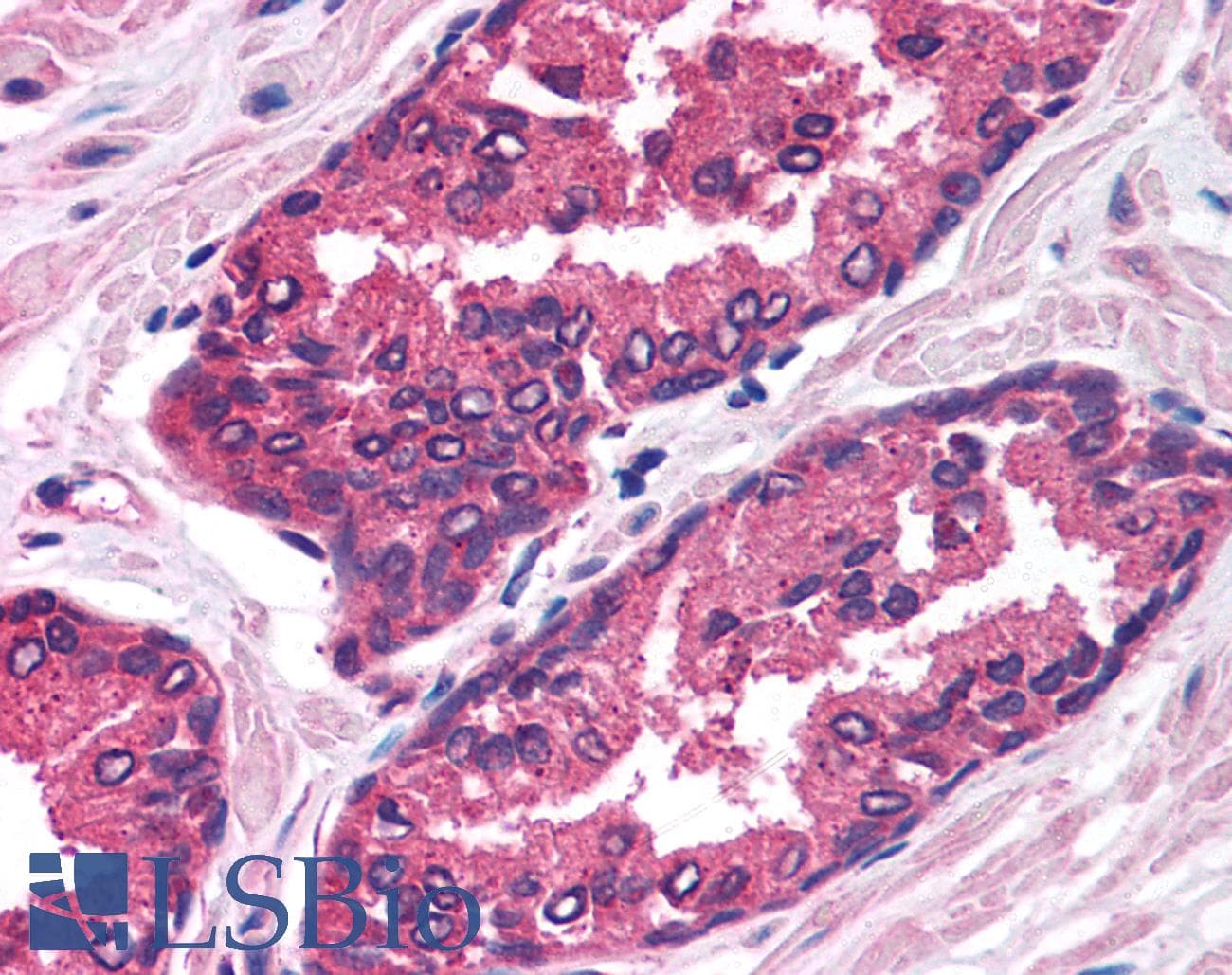 FOXP2 Antibody (aa71-120)