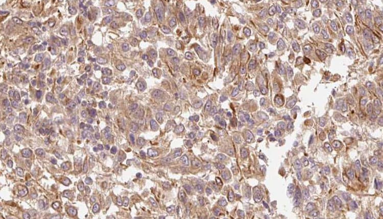 TGFB4 / LEFTY2 Antibody