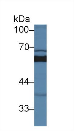 SUOX / Sulfite Oxidase Antibody (aa177-403, APC)