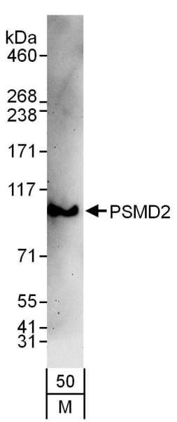 Polyclonal Rabbit anti-Human PSMD2 Antibody (aa50-100, IHC, WB)