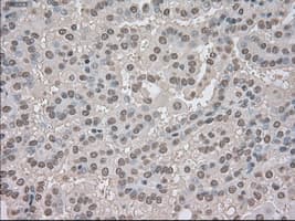 NTRK3 / TRKC Antibody (clone OTI2B8)