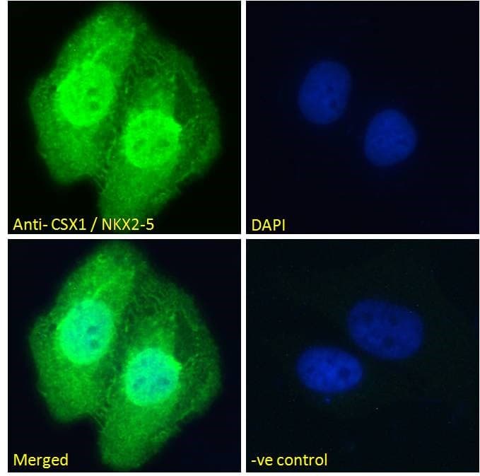 Polyclonal Goat anti-Human NKX2-5 Antibody (aa94-107, IHC, IF, WB)