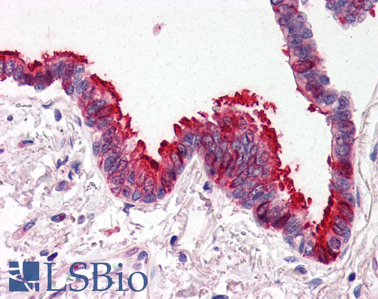 IHC-plus™ Polyclonal Rabbit anti-Human SKIL / SNO / SnoN Antibody (IHC, IF, WB)