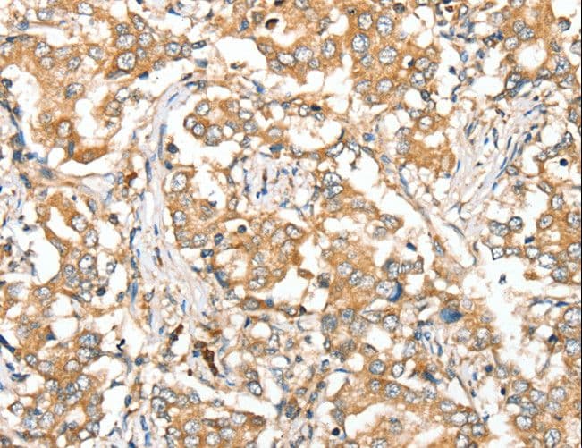 SIRT4 / Sirtuin 4 Antibody