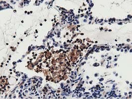 MICAL1 / MICAL Antibody (clone OTI6H4)