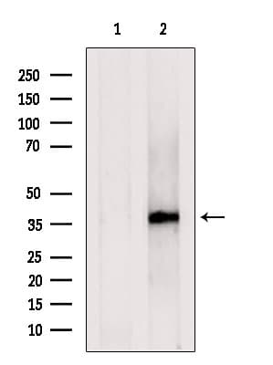 C1GALT1C1 Antibody