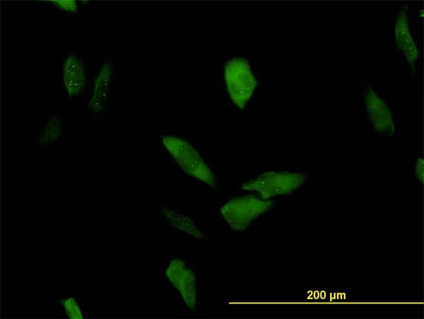 Monoclonal Mouse anti-Human TRIP / LRRFIP1 Antibody (clone 2D3, IF, WB)