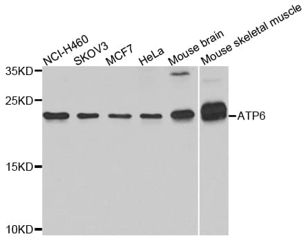 Polyclonal Rabbit anti-Mouse ATPASE6 / ATP6 Antibody (WB)