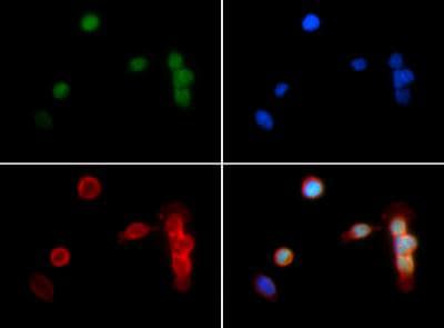 HIST3H3 Antibody (Me2-Lys18)