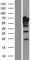 EPS8L1 Protein (Over-Expression Lysate Myc-DDK (Flag))