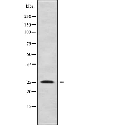 Polyclonal Rabbit anti-Human KLF16 Antibody (WB)