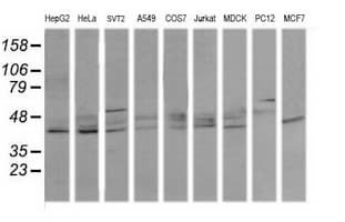 MAPK13 / p38delta Antibody (clone OTI12B2)