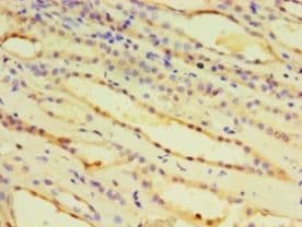 IDUA / MPS1 Antibody (aa28-653, Biotin)