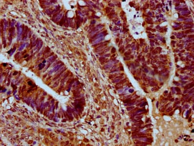 SRRM4 Antibody