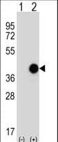CTSK / Cathepsin K Antibody (aa97-126)