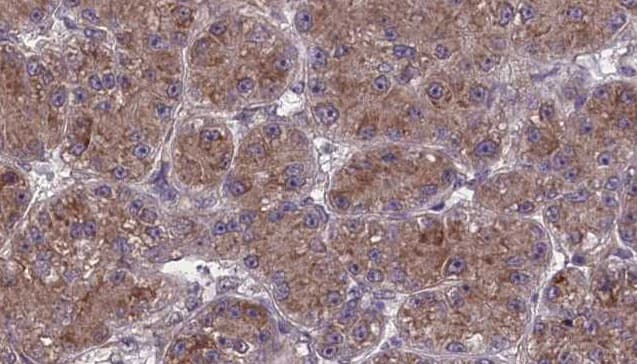OR2T27 Antibody