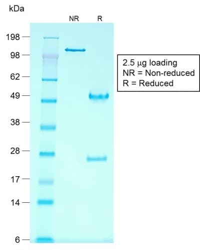 GPC3 / Glypican 3 Antibody (clone rGPC3/863, Azide-free, Carrier-free)
