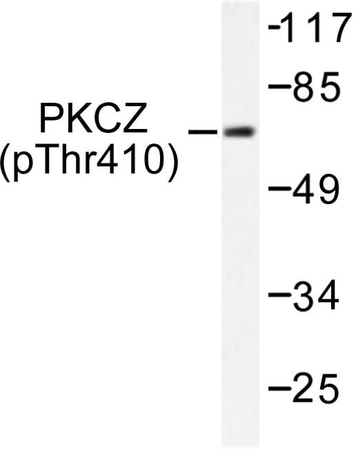PRKCZ / PKC-Zeta Antibody (phospho-Thr410)