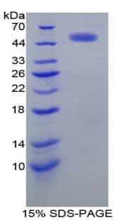 ERBB2 / HER2 Antibody (aa376-578, APC, Cy7)
