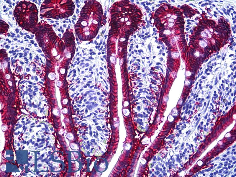 IHC-plus™ Monoclonal Mouse anti-Human EPCAM Antibody (clone VU-1D9, Concentrated, IHC, WB)