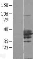 RHOXF2 Protein (Over-Expression Lysate Myc-DDK (Flag))