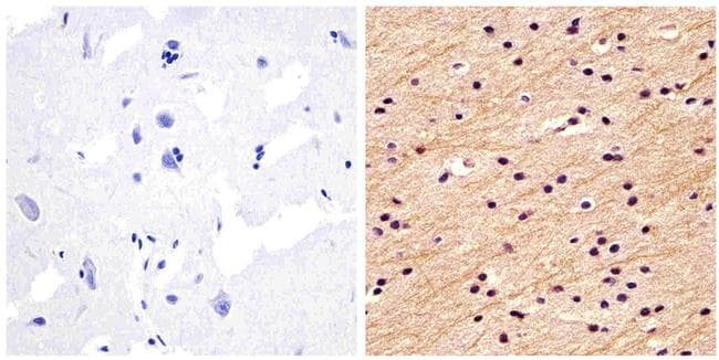NEFM / NF-M Antibody (clone RMO 14.9)