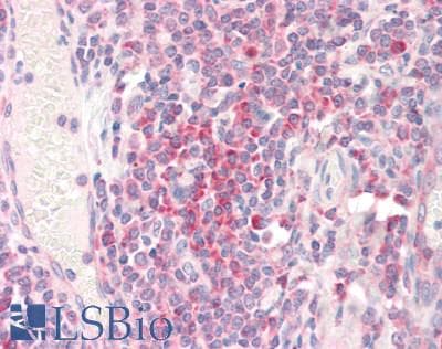 Polyclonal Goat anti-Human RPS19 / Ribosomal Protein S19 Antibody (aa111-122, IHC, WB)