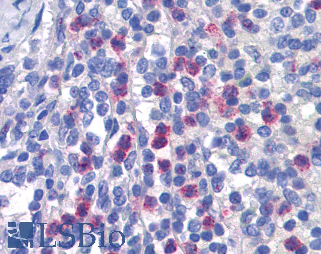 IHC-plus™ BANP Antibody