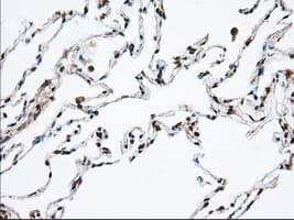 HMRF1L / MTRF1L Antibody (clone OTI2B5)