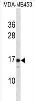 LIM2 Antibody (aa110-137)