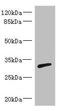 Polyclonal Rabbit anti-Human RPIA / RPI Antibody (IHC, WB)