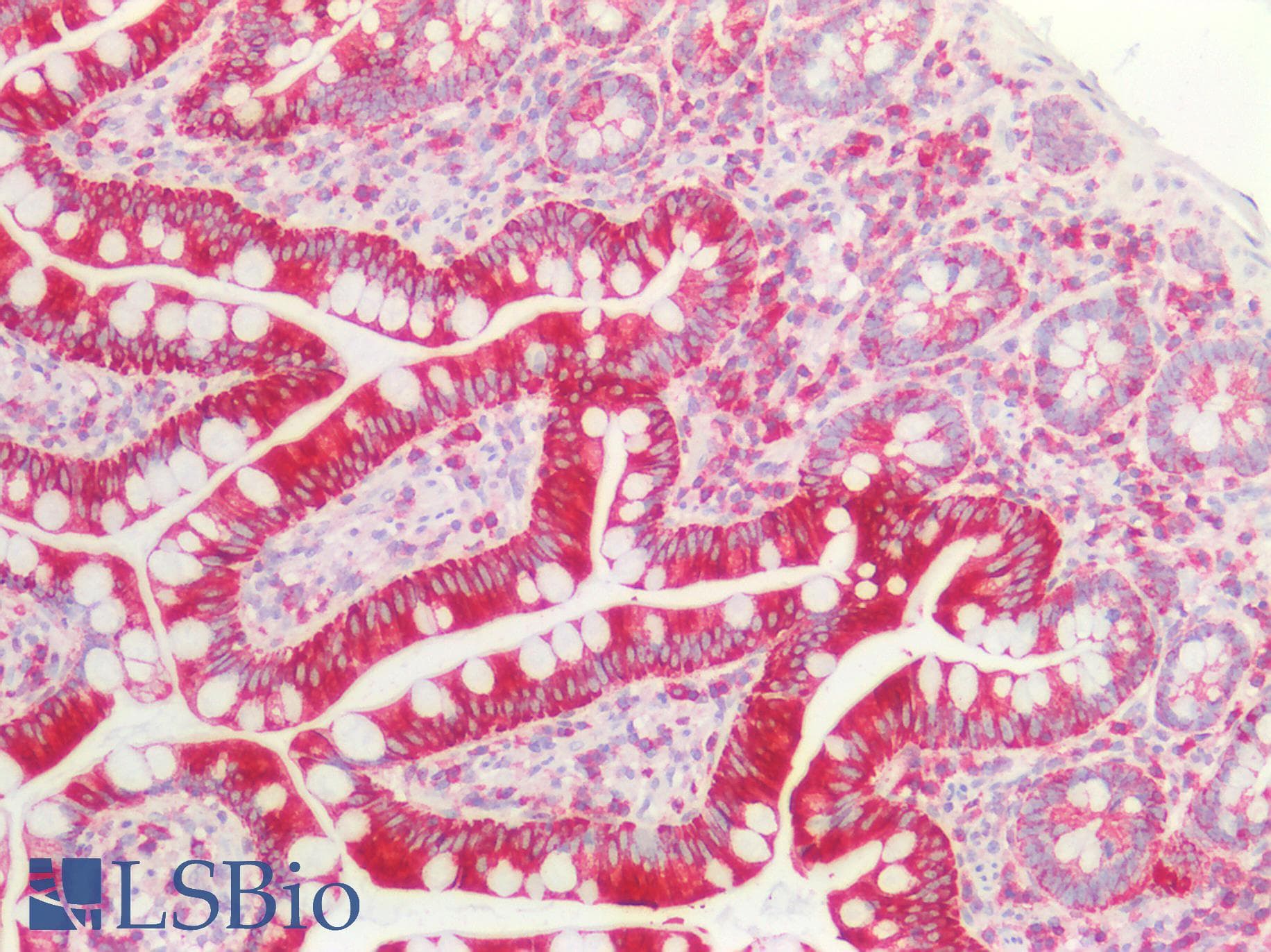 PathPlus™ KRT8 / CK8 / Cytokeratin 8 Antibody (aa25-74)