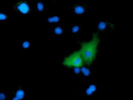 IHC-plus™ MICAL1 / MICAL Antibody (clone 2H1)