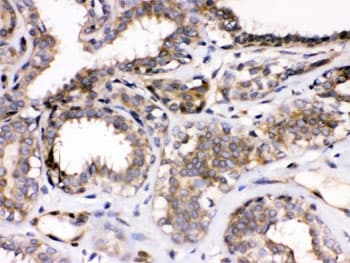Polyclonal Rabbit anti-Human PARVA Antibody (IHC, WB)