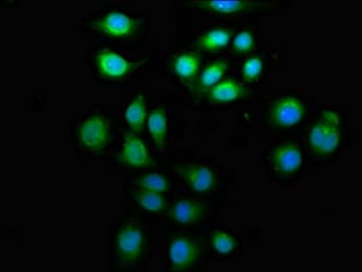 Polyclonal Rabbit anti-Human ARFGEF2 / BIG2 Antibody (IHC, IF, WB)