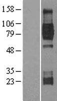 NTRK2 / TRKB Protein (Over-Expression Lysate Myc-DDK (Flag))