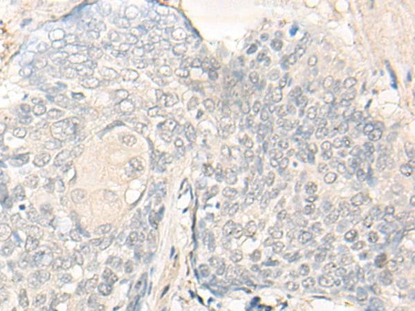 DIMT1L Antibody