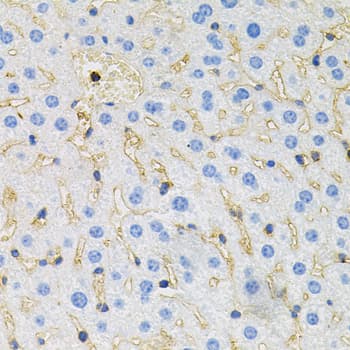 Polyclonal Rabbit anti-Human MAPT / Tau Antibody (IHC, IF, WB)