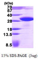 Human VAPB Protein (Recombinant His)