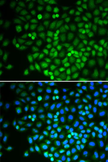 RPB16 / POLR2D Antibody