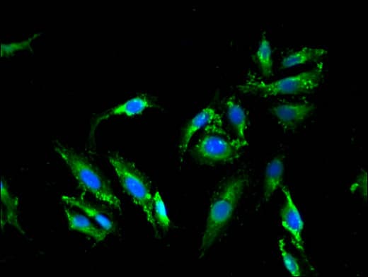 Polyclonal Rabbit anti-Human MLPH / Melanophilin Antibody (IHC, IF)