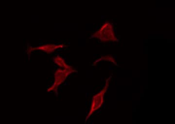 CASP3 / Caspase 3 Antibody