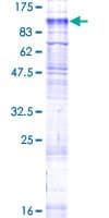 Human SLC26A6 / PAT1 Protein (Recombinant GST)