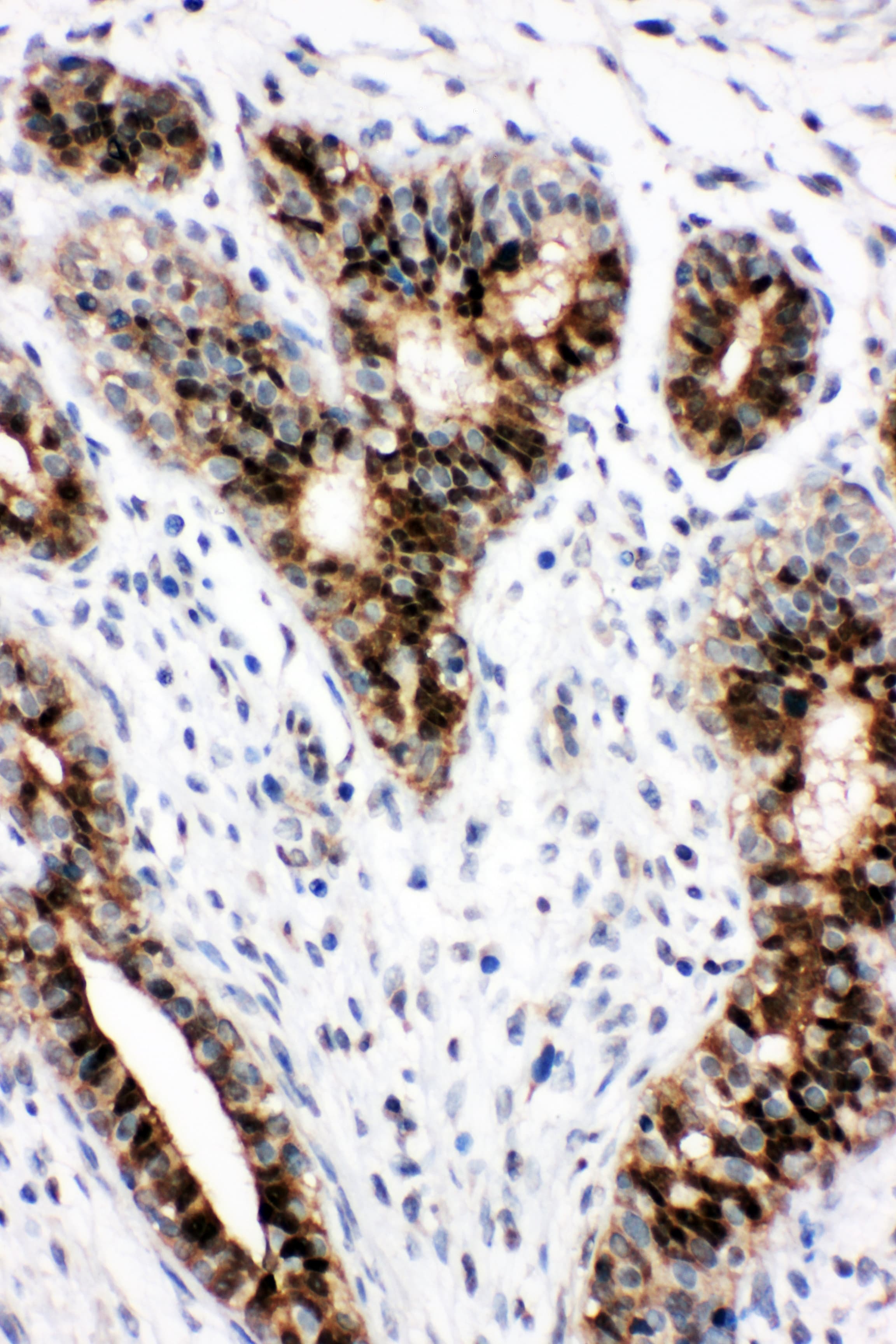 Polyclonal Rabbit anti-Human STAT5B Antibody (aa767-787, IHC, WB)