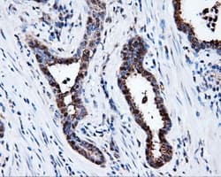PSMC3 Antibody (clone OTI8D6)