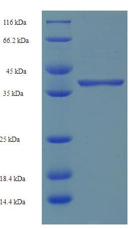 Human SRSF10 / FUSIP1 Protein (Recombinant His-SUMO)