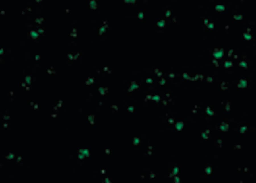 TICAM2 / TRAM Antibody