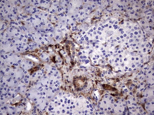 LGALS3 / Galectin 3 Antibody (clone OTI1C7)