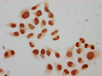 HIST1H2BN Antibody