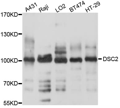 IHC-plus™ Polyclonal Rabbit anti-Human DSC2 / Desmocollin 2 Antibody (IHC, WB)
